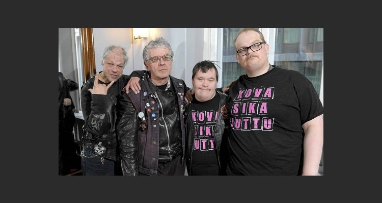 σύνδρομο Down